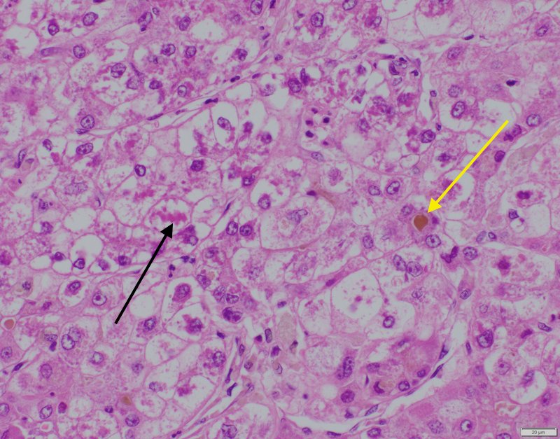 Unknown image 2 | Pathology Review for USMLE